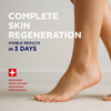 Regenerierende Spezial-Creme-Kompresse für rissige Fersen – 25% Urea