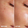 Serum for discoloration