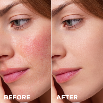 Magic Skin CC Moisturizing anti-redness cream 8in1 - Eveline
